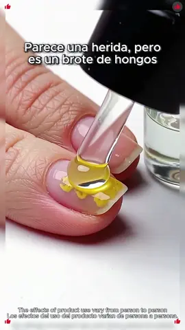 que utilizamos para la onicomicosis  #hongo #onicomicosis#nails  #fyp#TikTokShopfalldealsforyou