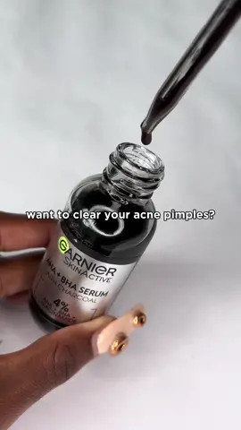 Best acne treatment 🖤🫧 #garnierea #breakupwithbreakouts #glowwithgarnier #skincare #fyp 