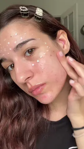 i was so scared 😭 my skin was red afterwards but in the next morning it was glowy and my skin kinda got better in appearance @VT Cosmetics US #reedleshot #vtcosmetics #koreanskincare #microneedling #skinfitness 
