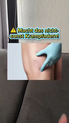 ⚠️ Wusstet ihr, dass Krampfadern oft durch langes Sitzen/Stehen entstehen? 😳 Ich hab diese Creme entdeckt und teste sie gerade – vielleicht hilft’s ja auch euch 🦵✨  Hier sind 5 einfache Tipps, um Krampfadern vorzubeugen 👇🦵✨ 1️⃣ Beweg dich regelmäßig – Spaziergänge, leichtes Joggen oder Radfahren regen die Durchblutung an. 2️⃣ Beine hochlegen – Mehrmals am Tag kurz die Beine hoch, um den Rückfluss des Blutes zu unterstützen. 3️⃣ Nicht zu lange sitzen oder stehen – Öfter Position wechseln, kleine Pausen zum Gehen einlegen. 4️⃣ Kompressionsstrümpfe tragen – Unterstützt die Venen und kann Schwellungen vorbeugen. 5️⃣ Gesunde Ernährung & genug Wasser – Ballaststoffe und viel Flüssigkeit helfen, die Gefäße zu stärken. #trust #korean #musthave #viral #omg 