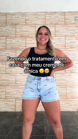 Enfim não preciso mais ter vergonha. #lipedema#celulite#flacidez#foryou 