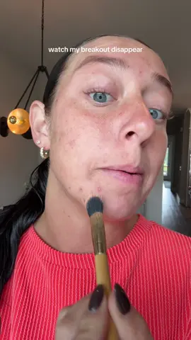 I woke up to a lot of painful breakouts on my chin thank goodness this @tarte cosmetics color corrector covers them up in SECONDS #breakout #skin #makeup #skiptips #colorcorrector 