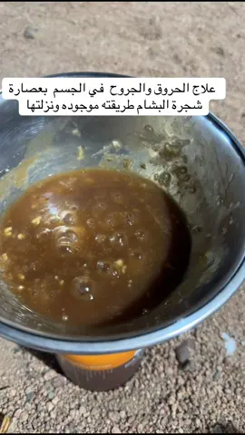 #فواز_ال_معمر #علاج_طبيعي #اكسبلور #هاشتاقات_تيك_توك_العرب #اكسبلورexplore 