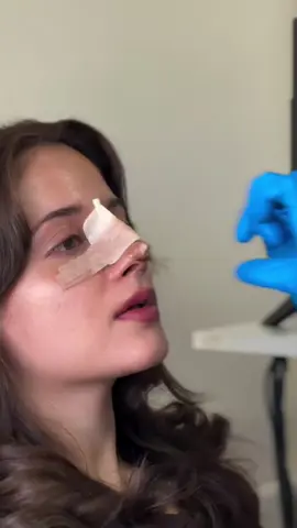 عملیة تجمیل الانف  #عملیة_التجميل_الأنف  #عملیة_التجميل_الأنف_في_ايران  #عملیة_تجمیل  #تجمیل_الانف  #انف_لحمي 