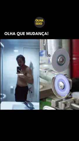 🚨 TRANSFORMAÇÃO INCRÍVEL! 🚨 Confira o antes e depois que vai te surpreender! ✨ Conteúdo exclusivo de @dr.lucasluquettioficial que realça a beleza! #mudança #estetica