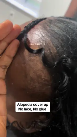 #alopecia cover up thinning hair loss style #protectivestyles #growinghands #braids #hair 