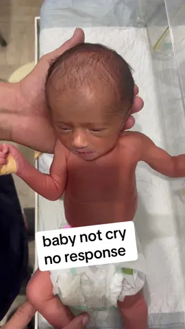 baby not cry no response #newbron #unfreezemyacount 