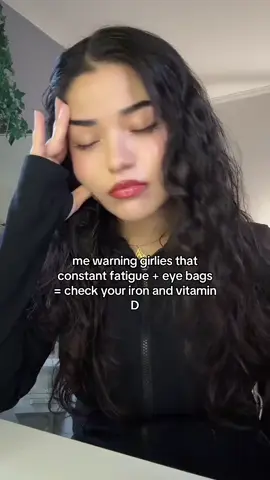 skipping vitamins shows up under your eyes first #eyebags #iron #anemic #skincare 