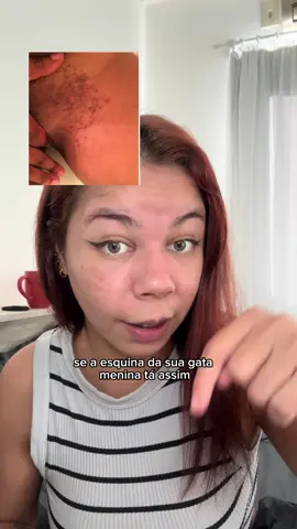 O nome dele tá no carrinho laranja ☝️#mulheres #clareadordemanchas #virilhasemmanchas 