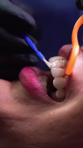 Edição de vídeo que faz toda diferença ✨💫 Siga e conheça como podemos transformar seus vídeos! #foryoupage #fy #odonto #smiledesign 