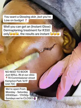 Instant Glow treatment available for R350 only  Suitable for those attending events (Weddings,parties,Graduations etc) #instantglow #dermaplaning #kemptonparkaesthetics #trendingskincare #fyp 