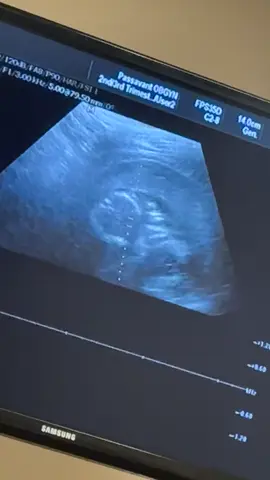I love you sweet girl 💕 almost 17 weeks now #pregnant #babygirl #secondbaby #girlmom 