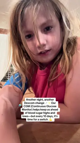 Another night, another Dexcom change 💉 For those who may not know, Arya wears a Dexcom CGM (Continuous Glucose Monitor). This little device is life-changing for people with Type 1 Diabetes. Instead of finger pricks all day long, the Dexcom tracks glucose levels 24/7 and sends alerts when sugars are trending too high or too low. The catch? Each sensor only lasts 10 days, so we have to switch it out regularly. That means another site, another insertion, and another adjustment for her little body. While it may seem like a quick swap, it’s a constant reminder of the daily work that goes into managing T1D. The technology is incredible, and we’re beyond thankful for it—but it doesn’t erase the challenges that come with it. Behind every device is a strong warrior who faces this battle every single day. 💙 Here’s to another 10 days of data, safety, and peace of mind 🙏 #Type1Diabetes #Dexcom #CGM #T1DStrong #DiabetesAwareness @WaffleWiggler 