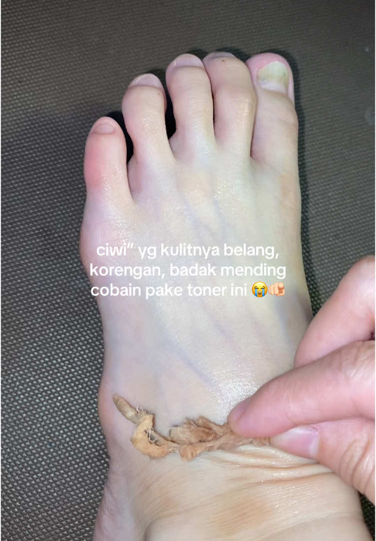 nampol banget tonernyaaa! bikin kulit makin hari makin ceraaah ga belang lagiii 🥹🫶🏻 #bodycare #bodytoner #tonerbadan #tonerbadanwhitening #pemutihbadan 