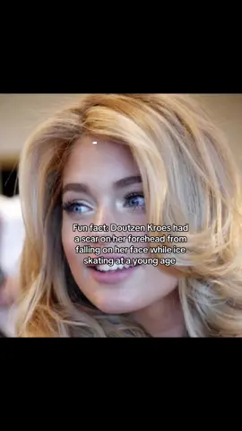 It’s barely noticeable though #doutzenkroes #scar #model #victoriassecret #viral 