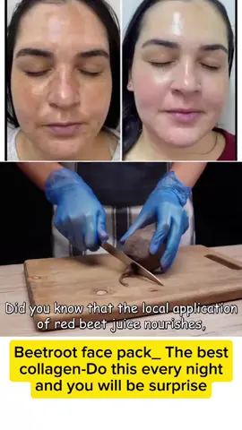 Beetroot face pack_ The best collagen-Do this every night and you will be surprise#skincareroutine #beauty #fyp #skinwrinkles #skincare 