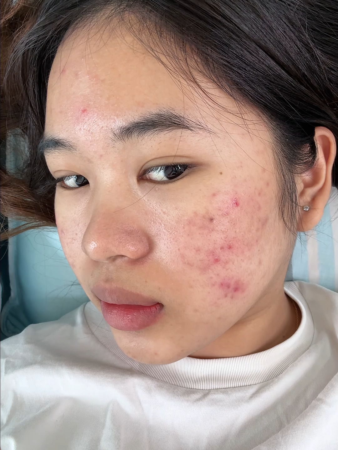 Ai từng trải mới hiểu cảm giác của tui #gelmunzincerra #azderma #routine #skincare