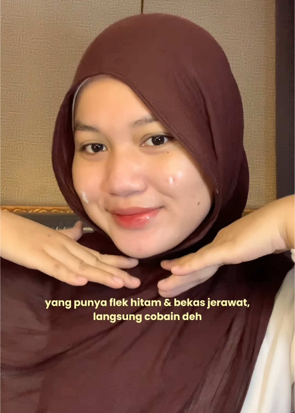 bye bye flek hitam dan bekas jerawat👋🏻☺️ #chalonese #flekhitam #flekhitambandel #chalonesecream #chaloneseskincare 