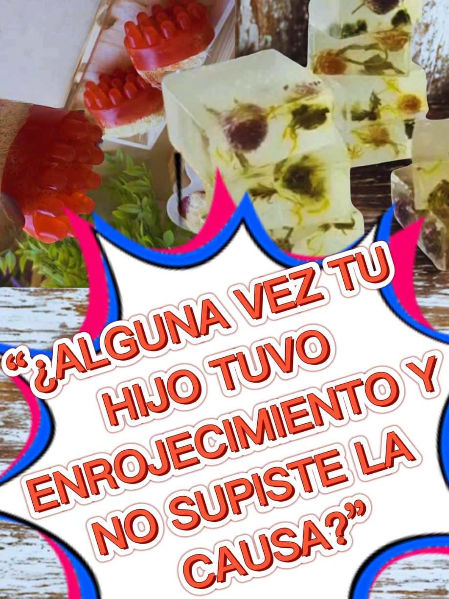 👶💔 “¿Alguna vez tu hijo tuvo la piel roja y no sabías por qué?” A nosotros nos pasó… probamos cremas y remedios, pero nada funcionaba 😔. Hasta que descubrimos que el jabón era la causa 🚫🧼. Cambiar a jabones naturales 🌿✨ fue un alivio enorme y nos enseñó a mirar siempre las etiquetas 🏷️. 💬 Cuéntanos tu experiencia en los comentarios. 👀 Síguenos para más consejos, comenta ALIVIO si lo viviste, comparte este video 🔄 y escríbenos por privado 📩 si quieres aprender a hacer jabones seguros. #soapmakingtiktok  #jabonescaseros  #jabonesdecorativos  #jabonesartesanales  #jabonesdeglicerina  #hechoamano  #velasartesanales  #velasaromaticas  #jaboneshechosamano  #soapaddict  #artesania #hechoconamor  #emprendeconjabones 