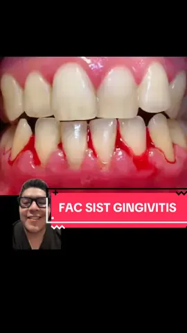 FACTORES SISTÉMICOS ASOCIADOS CON GINGIVITIS.  #dentistaentiktok #dentista #AprendeEnTikTok #estudiantes #odontologia 