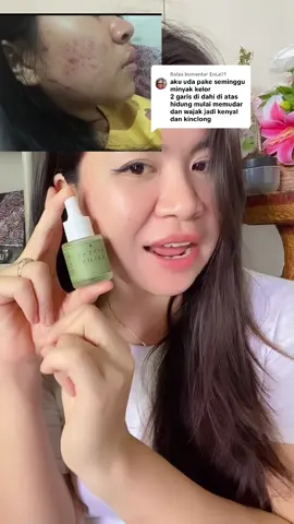 Membalas @EnLe71 terimakasih review baiknya Kaka syg #minyakkelor #solusiflekhitam #solusiwajahcerah #lulurbugis 