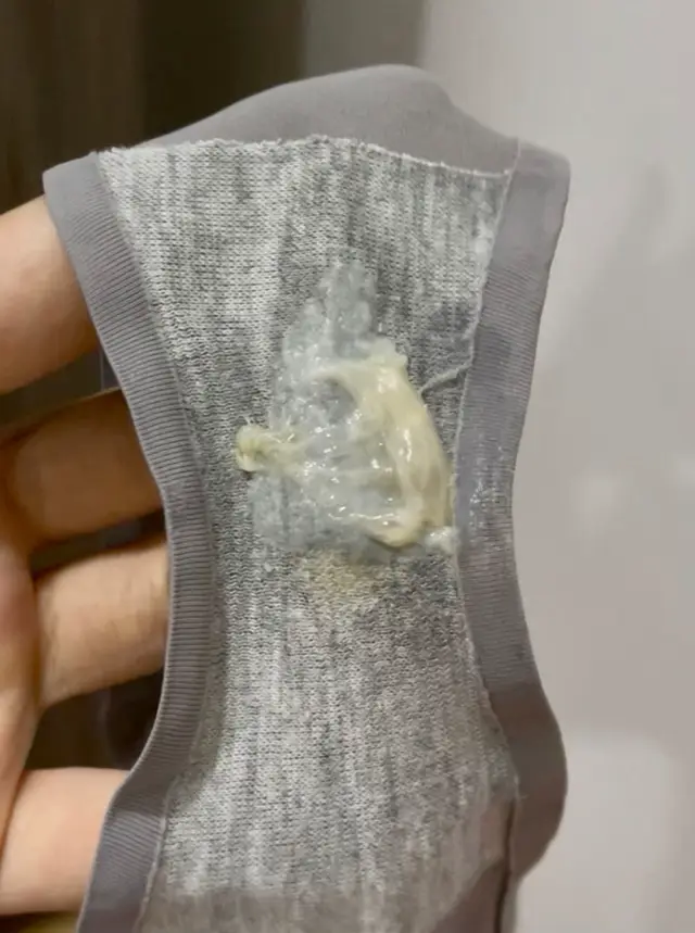 Ai bị thế này không ?#viemphukhoa #namcandida #khihuhuyettrang #viemlotuyen 