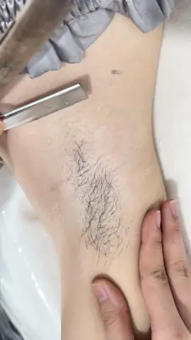 Nên triệt lông nách vì 👉🏻 #triệtlôngvĩnhviễn #camispadanang #xuhuong #viral #trietlonglanhhieuquadanang 