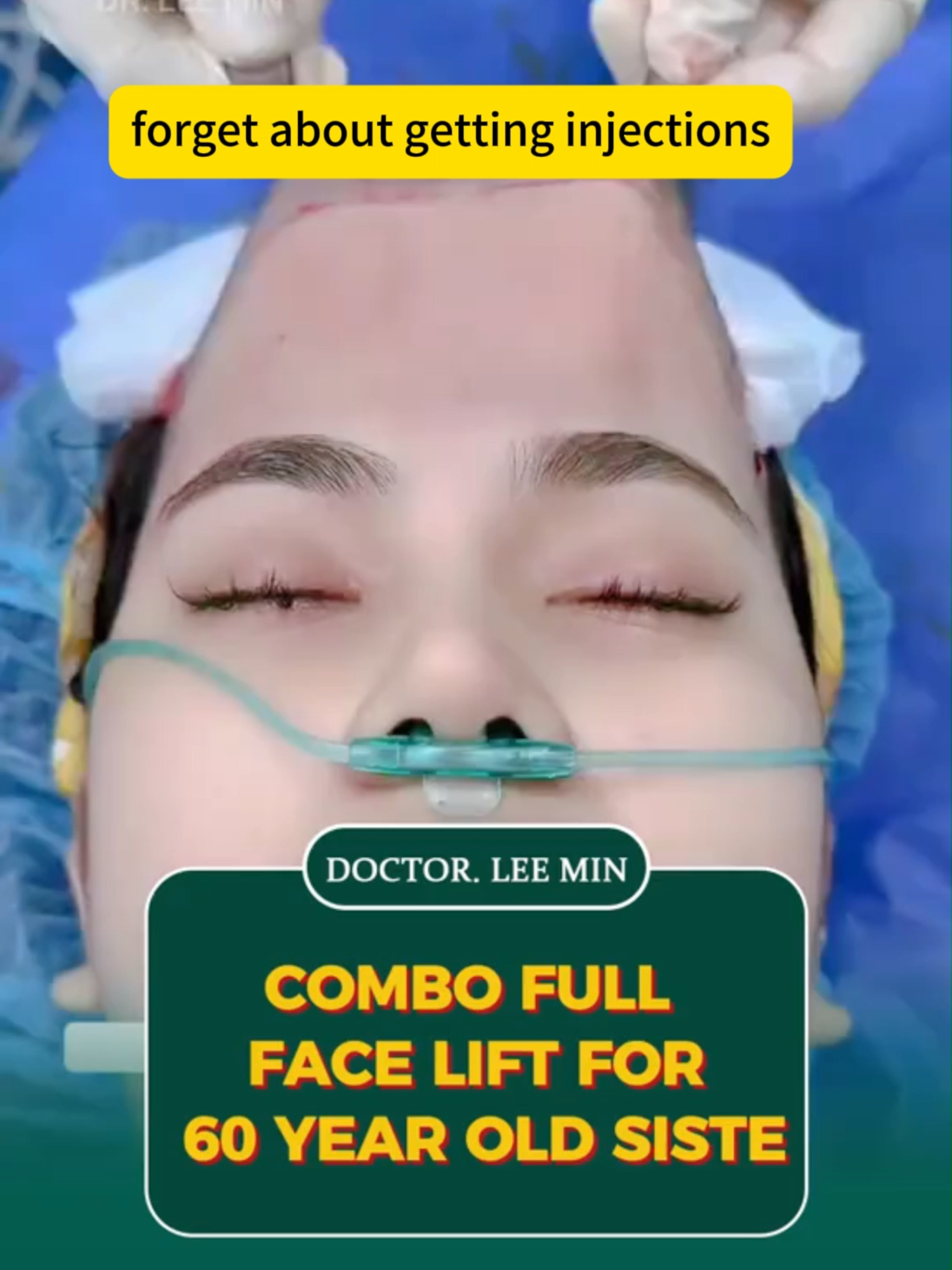 Ang paborito kong cream ay nasa sale ngayon cmz-10.1-hfs8#skin #anti-aging #wrinkles #linyasamukha #NeckFirmingCream #TightenandLiftNeckCream #botoxbeevenomfacecream #botoxcreamoriginal #beevenomcreamoriginal