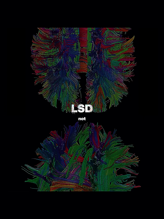 El LSD #psicologia #neurociencia #cerebro 
