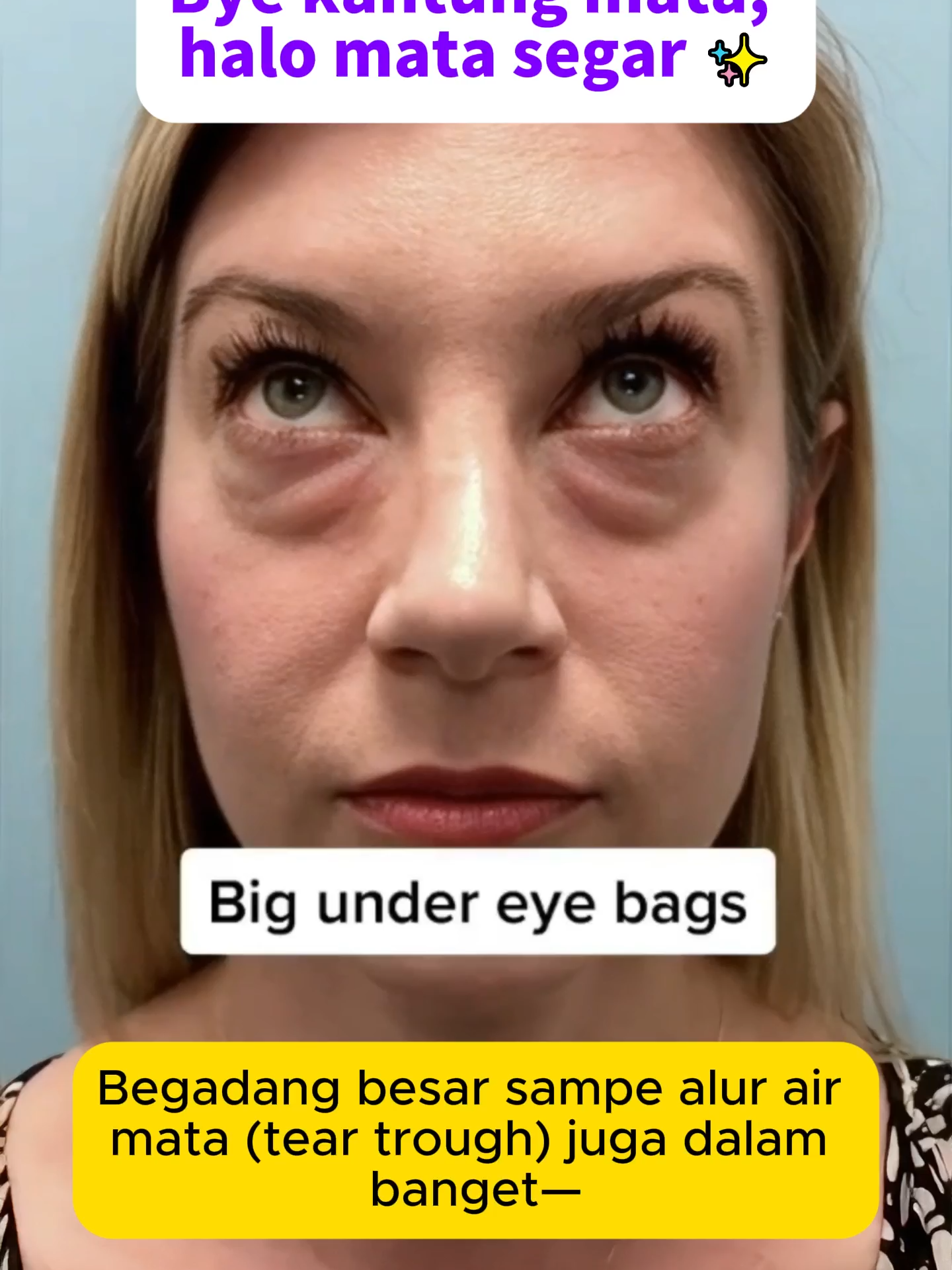 Satu menit langsung kelihatan? Eye cream ini beneran ajaib!#eyecream #eyebags #foryou #skincare #darkcircles