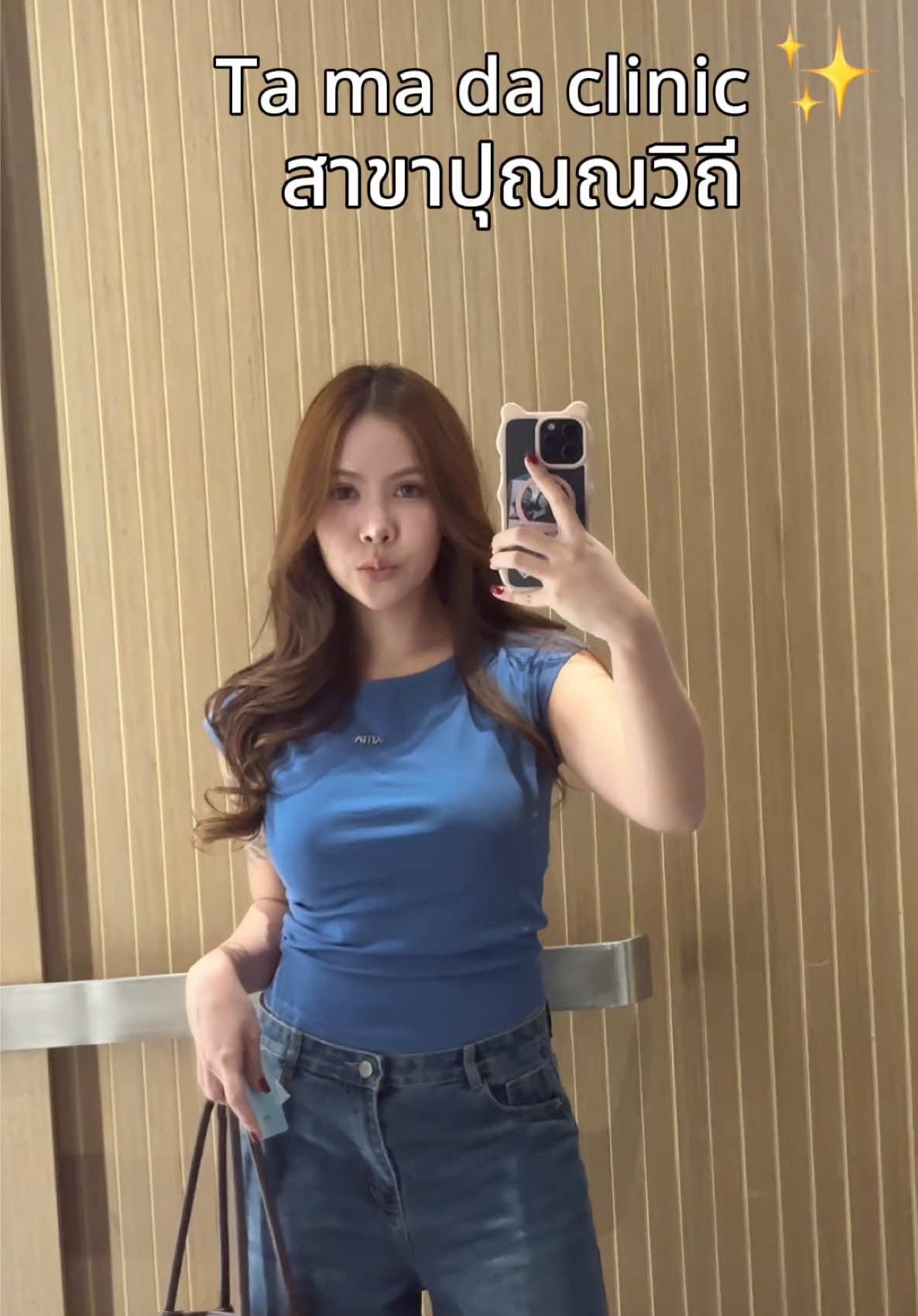 อัปเดท 20 วัน ✨💖 #หัตการความสวย #botox #ฟิลเลอร์ 