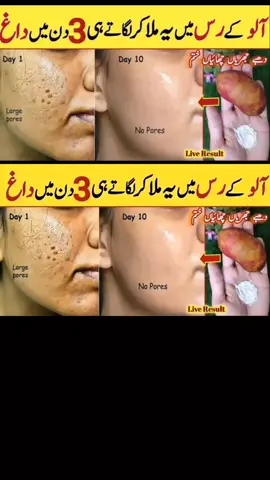 Remove Suntan in Just 5 Minutes ✨ | 100% Natural Home Remedy