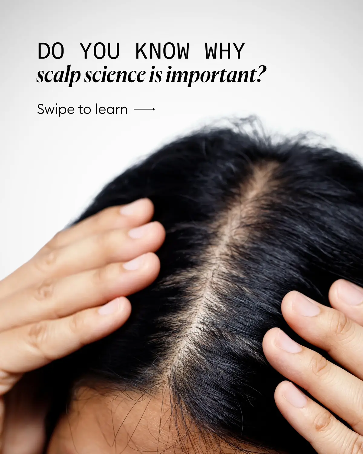 Scalp science is 🔑 to target the scalp, root, and strands with the right ingredients to support healthier hair from root to tip. Click the link in bio to shop hair care that provides clinical results you can see and feel 💙  #nioxin #scalpscience #scalpcarematters #healthyscalphealthyhair 
