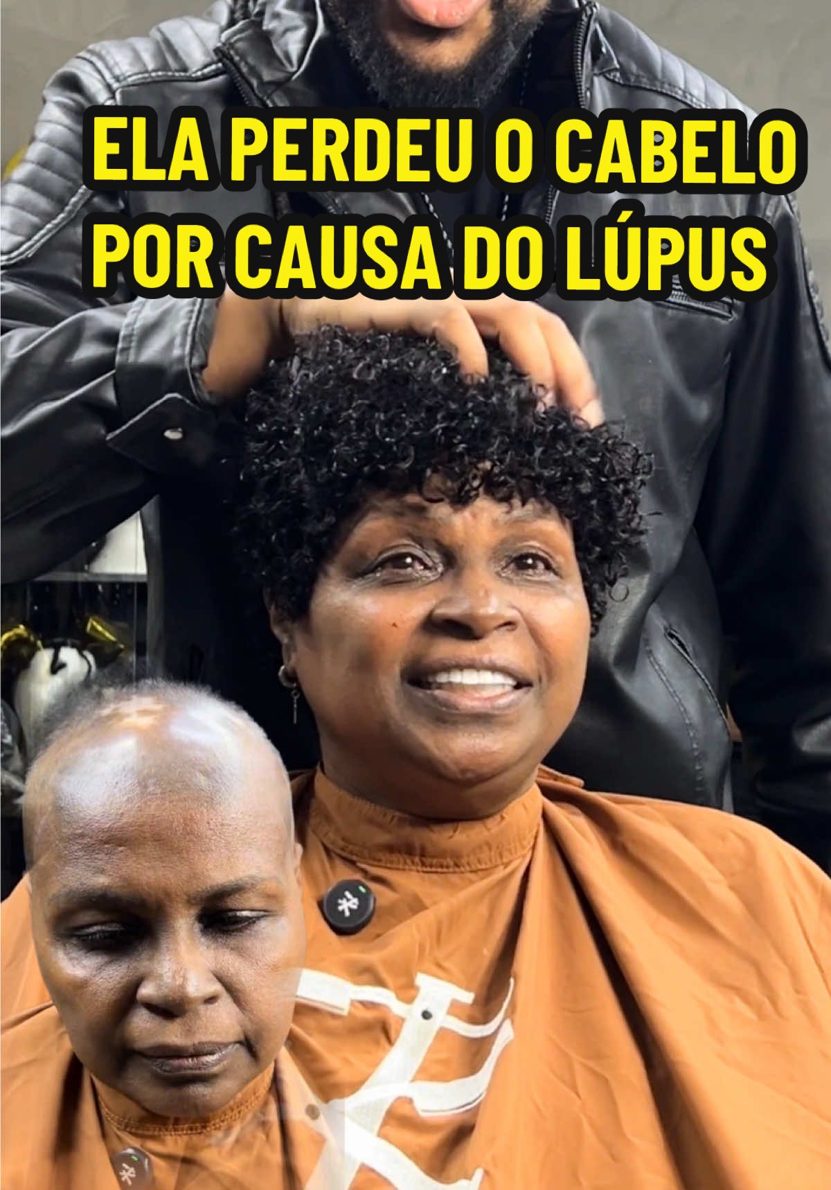 ✨ A história da Dona Ana nos emocionou profundamente. Ela enfrentou a queda de cabelo causada pelo lúpus, e com isso também perdeu parte da sua autoestima. Ela entrou no estúdio acompanhada de uma amiga que se emocionou junto por saber o que ela passava por conta da condição ao lúpus.A Ana se emocionou  junto, nós da equipe nos arrepiamos, e no final… foi impossível segurar as lágrimas. A transformação foi tão forte que ela abraçou todos no estúdio. 🌹 O sorriso dela depois da prótese mostrou que não se tratava apenas de cabelo, mas de vida, autoestima e felicidade de volta. 💇🏾‍♀️ Histórias como a da Dona Ana provam que prótese capilar é muito mais do que estética — é transformação de vida real. Obrigado @anadinizd será sempre bem vinda 🫶🏾 👉 Se você conhece alguém que precisa recuperar a confiança, marque aqui. Essa mensagem pode mudar um destino. 