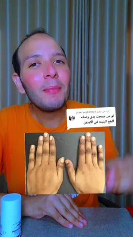 الرد على @userzyuyh1d8v2  تصبغات الايد  #mohamed_adel🇪🇬 #اكسبلور #explore #fdyツ #CapCUt 