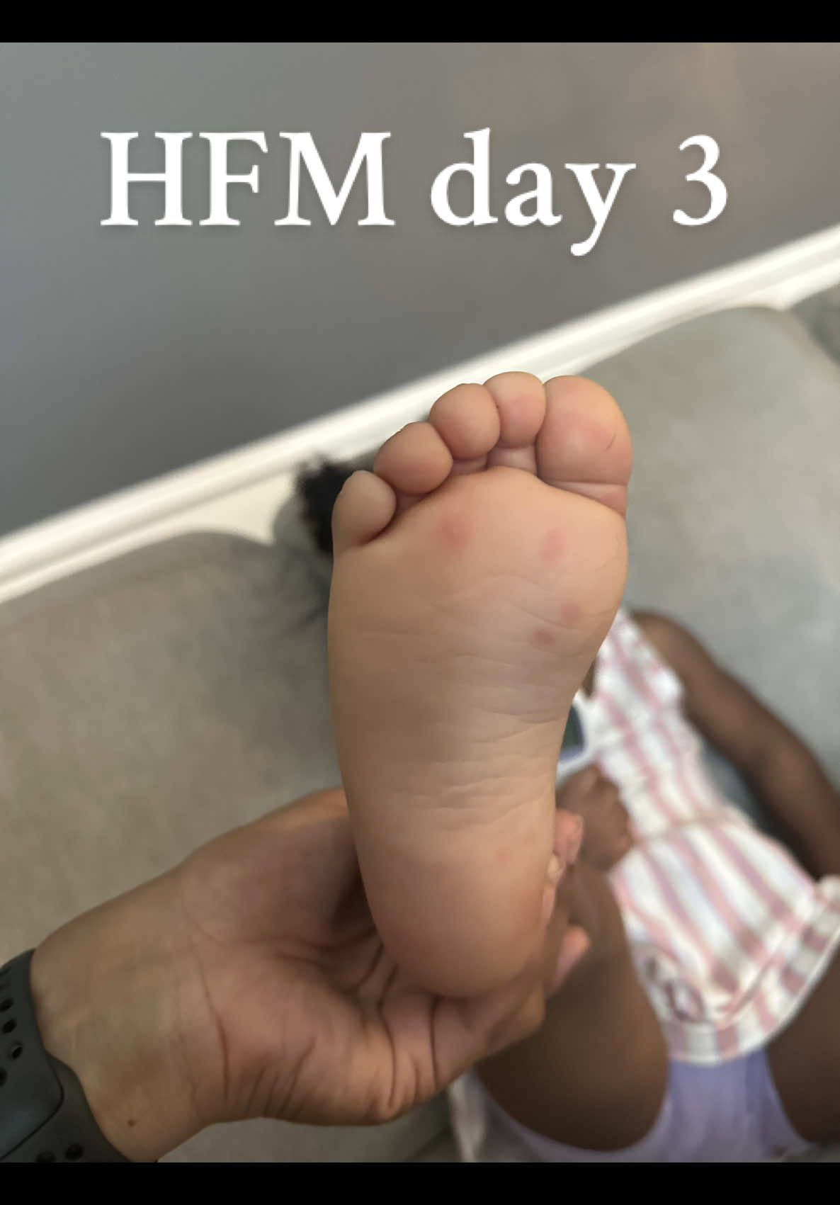 Day 3 of hand foot mouth. Thank yall for allll the comments with tips and everything! I appreciate yall real bad! #MomsofTikTok #twinmom #sahmlife #handfootmouthdisease #houstonmom 