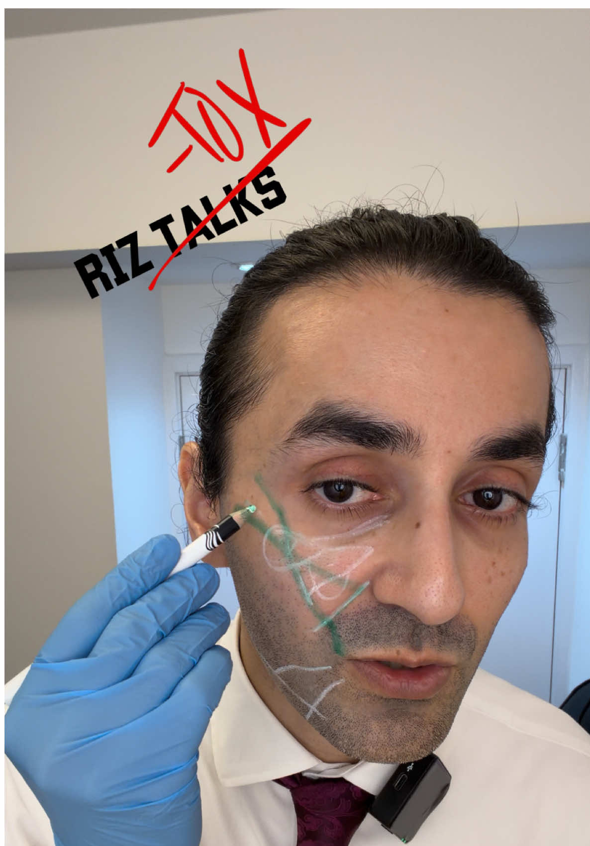 Riz Talks on Mid Face Filler 🧡  #riztalks #westerwoodhealthglasgow #cosmetic #botox #fyp 