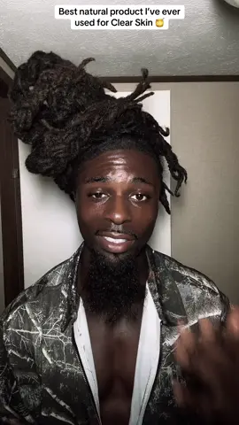 Best natural product I’ve ever used for Clear Skin  #skincare #glassskin #fyp #viral #locs 