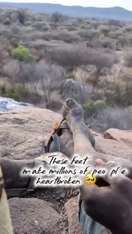 Chaaba's legs 🥺 #hadzabe #hadzabetribe #chaaba #dudukwe #chabafromhadzabe 