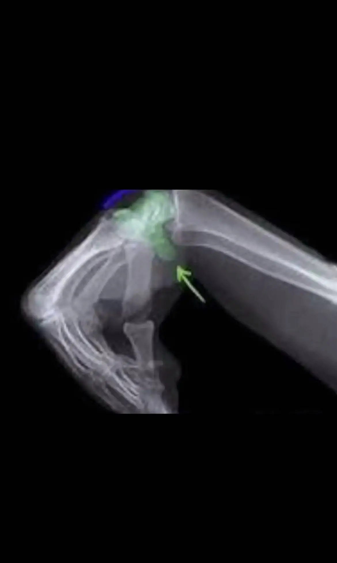 #basketball #hoops #fy #hoops 