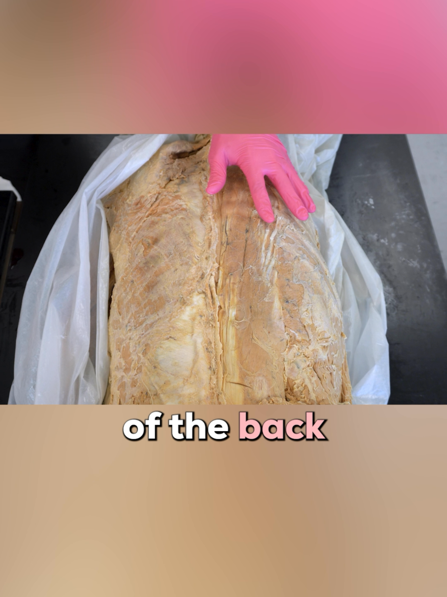 BACK PAIN 101: Why Your Muscles 