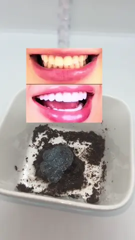 Pour avoir des dents blanches dès la première utilisation  😱#pourtoi #fyp #astuce 