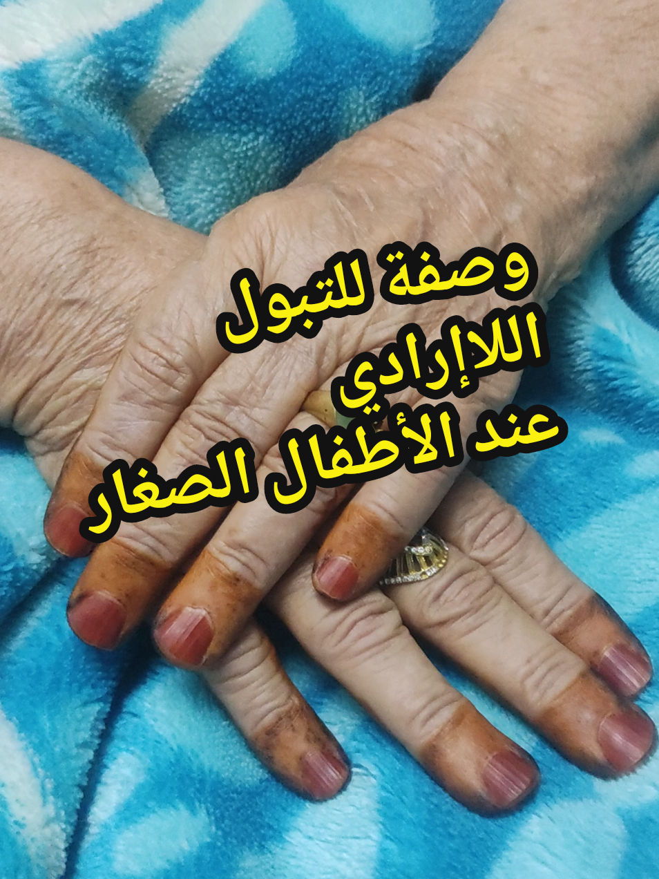 الرد على @abdalbasate__05  وصفة للتبول اللاإرادي عند الأطفال الصغار. #ناس_زمان_قالوا  #وصفات_ناس_زمان  #ناس_زمان  #tiktokalgeria  #explore 