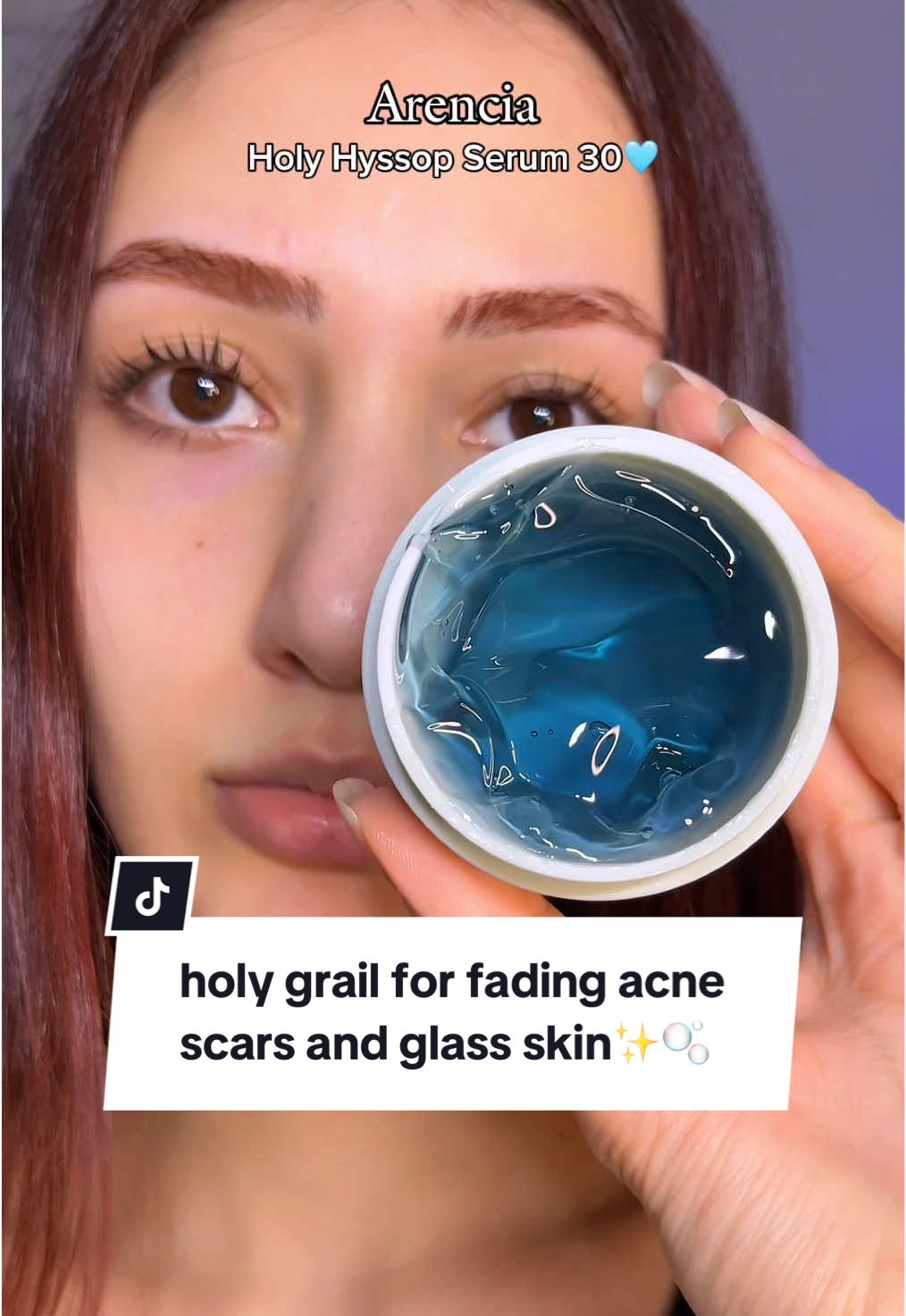 this serum is a holy grail for fading dark spots and acne scars + instant glass skin glow ✨🩵 @Arencia #glassskin #acnescars #arencia #koreanserum #viralskincare 