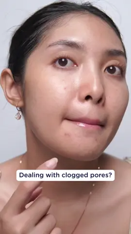 Four ⭐ ingredients inside of our Acne Gel Wash: Salicylic Acid to exfoliate, unclog pores and clear acne Zinc PCA helps reduce the look of redness and targets excess oil 🎯 Blue Algae soothes & moisturizes💙 Antioxidant Green Tea Extract helps rejuvenate the look of your skin 🍵 Need we say more? 🤭 #panoxyl #ultabeauty #acneskincare #acne #cloggedpores #salicylicacid 