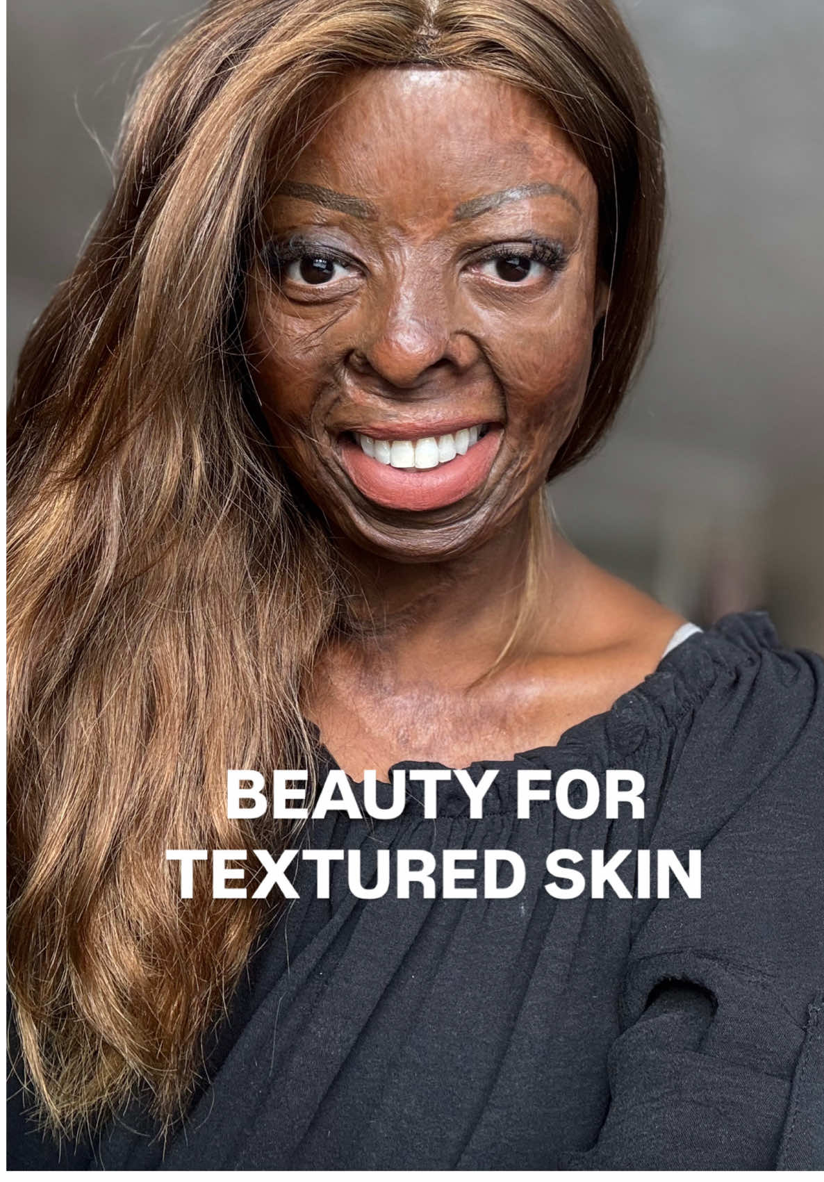 Here, beauty + skincare exist with scars. #girls #fyp #disability #ukmakeup #makeuptransformation @Fenty Beauty @Morphe 2 @nyxcosmetics_uk 