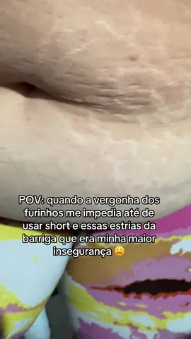 Tô nem acreditando 🥺 #fypシ゚ #tiktokshop #cremerosa #lipedema #estrias 