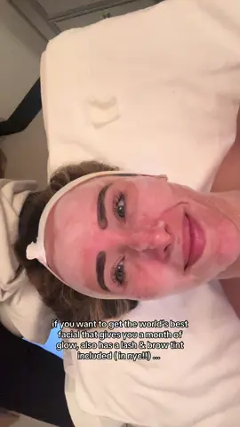 my skin is illuminated for a month when I leave @isabellemcleodaesthetics 