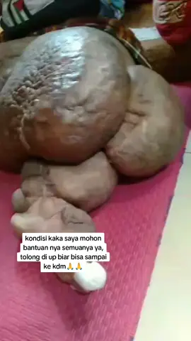 @kdm.unofficialls @dennysumargoreal @kdmfans2029 