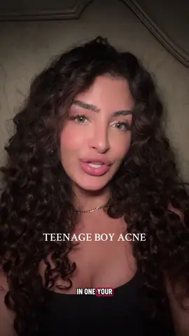 Teenage boy acne with your favorite dermatologist.. let’s talk 🫠 #dermatologist #teenskincare #skintok #skincareroutine #dermatologist 